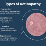 Key Components of Comprehensive Care for Diabetic Eye Disease