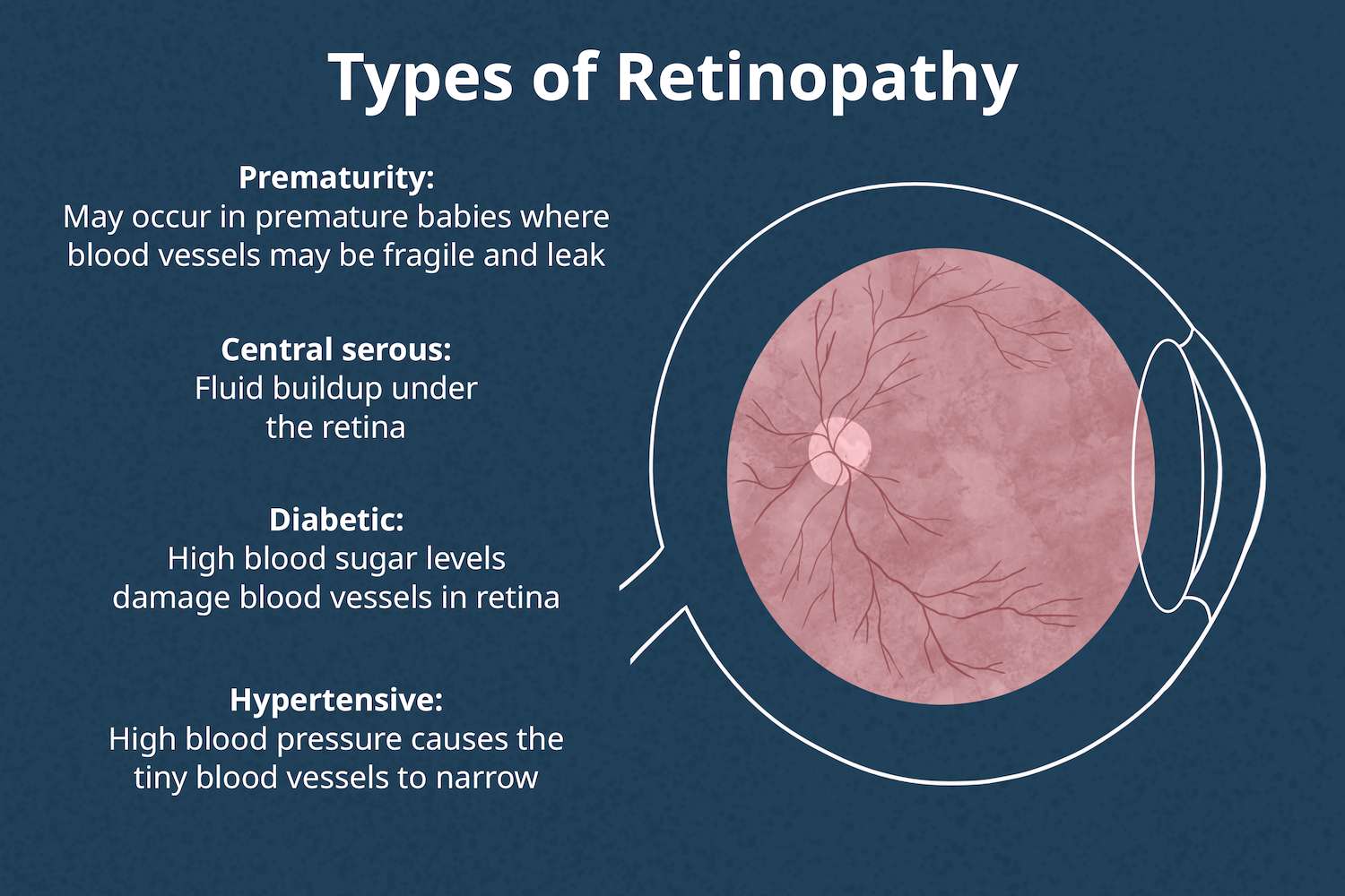 Key Components of Comprehensive Care for Diabetic Eye Disease